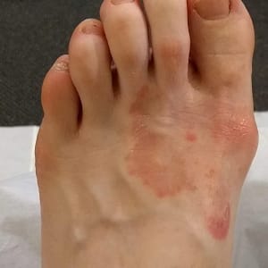 5 TIPS TO KEEP YOUR FEET HEALTHY AND FUNGUS-FREE